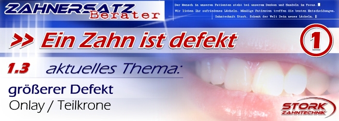 Ein Zahn ist defekt